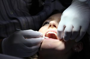 Proč se některým lidem kazí zuby, přestože si je správně čistí?