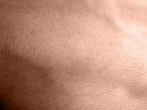 Zhoubné nádory kůže - melanom, bazaliom a jejich léčba